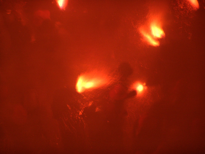 PATUM DE BERGA (104)